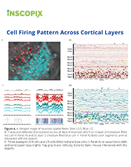 nVista-Poster-Cortical-Cover.png