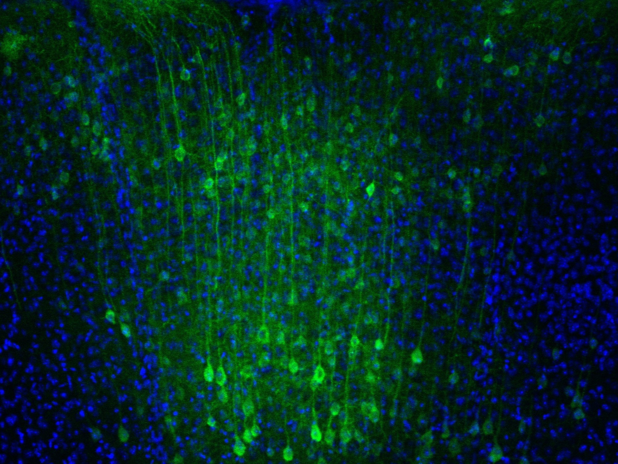 Mapping Neural Circuits in Real - 20160115 V AAV5 1to4 Lhem S1 1 S72 10x 1s Comp 232580 Edited 
